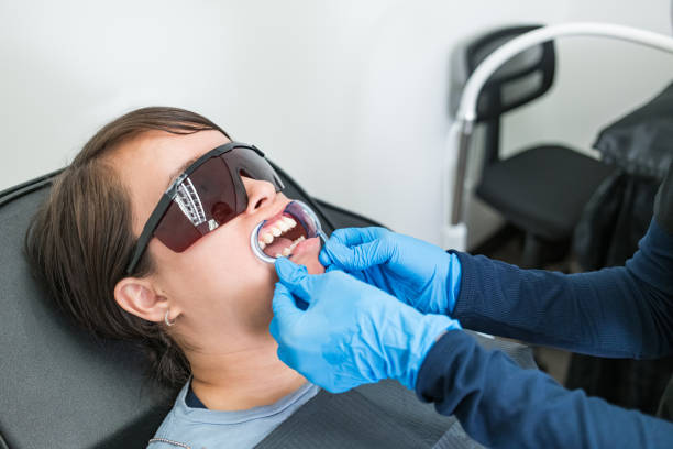 Best Teeth Whitening  in Vincent, AL