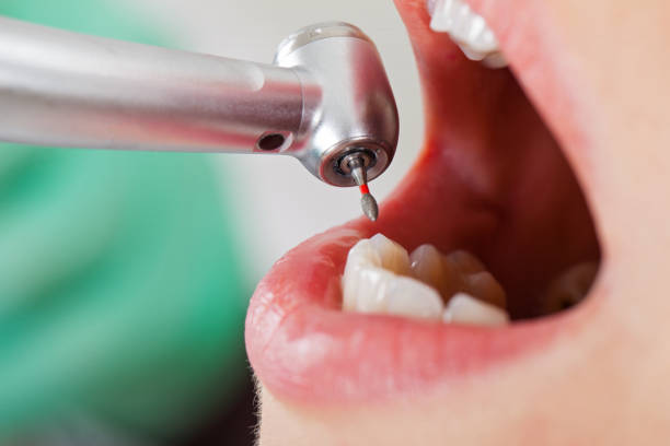 Best Urgent Tooth Repair  in Vincent, AL